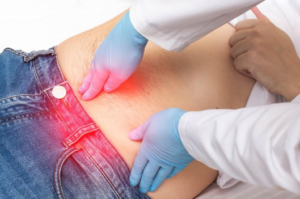 cirurgia robotica hernia inguinal