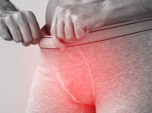 candidiase masculina