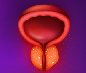 sintomas da próstata inflamada