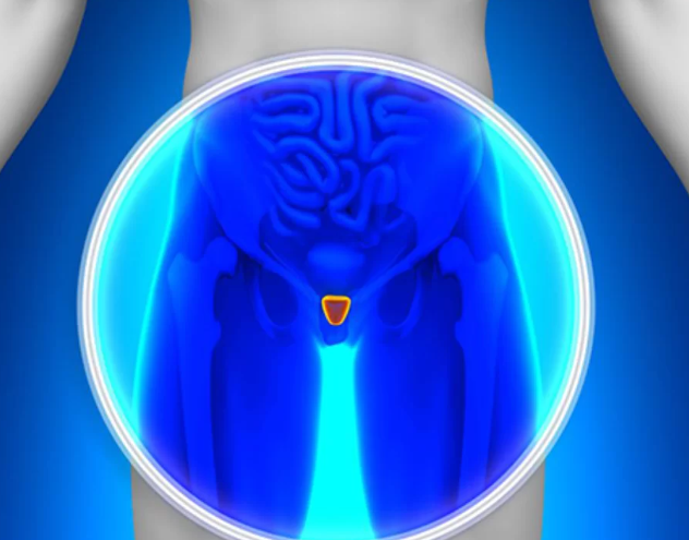 como fica a ejaculação após retirada da próstata