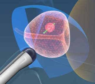 como é feito biopsia de prostata