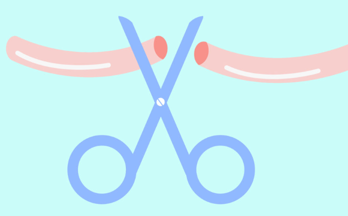 como funciona a vasectomia