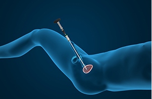 como é feito o exame de cistoscopia