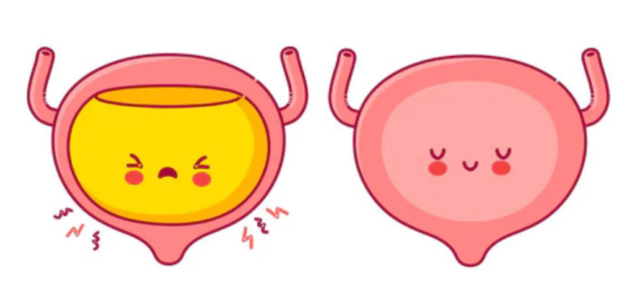 esvaziamento incompleto da bexiga