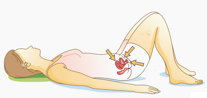 exercicios de kegel para incontinencia urinaria de esforço